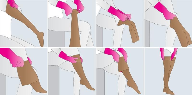 Компрессионный трикотаж: как правильно выбрать и использовать для профилактики и лечения венозных заболеваний